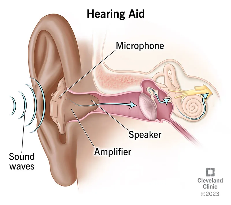 Hearing aids: how they work and how to get used to them
